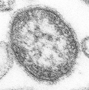 This thin-section transmission electron micrograph of the measles virus.