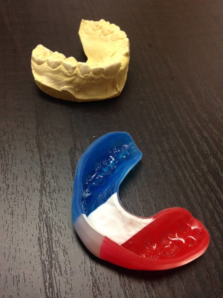 Custom Sports and Mouth Guards!