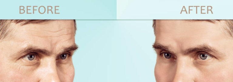 Rejuven-Age.   Look less stressed, less tired, younger and healthier.